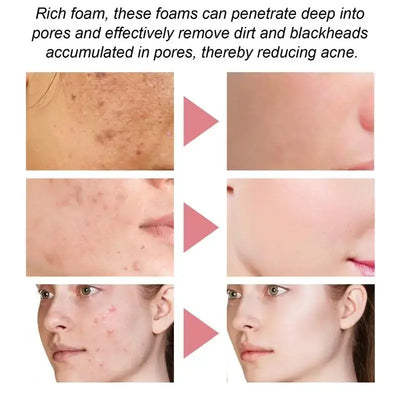 Frost Glow Cosmetics foaming facial cleanser deeply cleanses, controls oil & removes blackheads while keeping skin soft & hydrated.