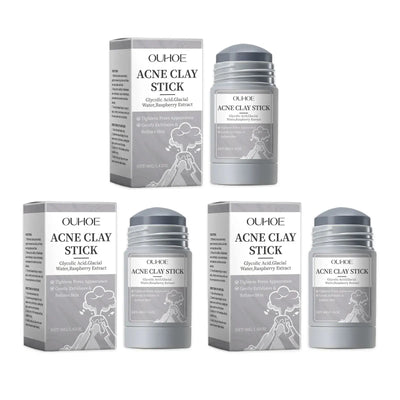 Frost Glow Cosmetics clay mask shrinks pores, removes blackheads, controls oil & hydrates skin for acne & pimple treatment.