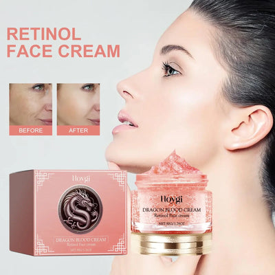 Frost Glow Cosmetics retinol night cream firms skin, reduces wrinkles & fine lines. Hydrating 50g anti-aging moisturizer with vitamin E.