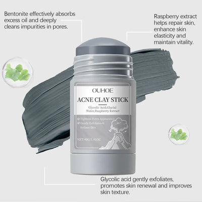 Frost Glow Cosmetics clay mask shrinks pores, removes blackheads, controls oil & hydrates skin for acne & pimple treatment.