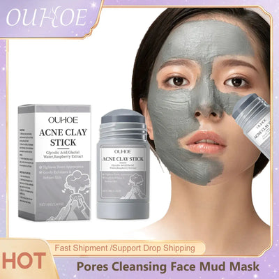 Frost Glow Cosmetics clay mask shrinks pores, removes blackheads, controls oil & hydrates skin for acne & pimple treatment.