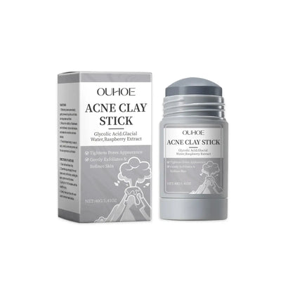 Frost Glow Cosmetics clay mask shrinks pores, removes blackheads, controls oil & hydrates skin for acne & pimple treatment.