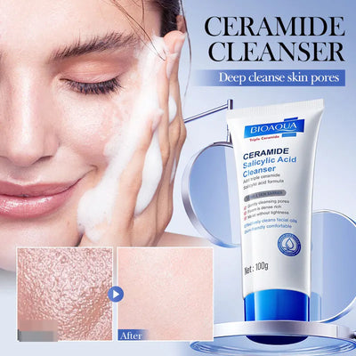 Frost Glow Cosmetics salicylic acid cleanser fights acne, controls oil & gently whitens skin. Mild daily facial wash for clear skin.