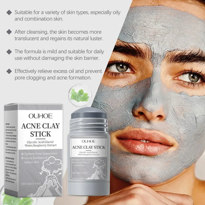 Frost Glow Cosmetics clay mask shrinks pores, removes blackheads, controls oil & hydrates skin for acne & pimple treatment.