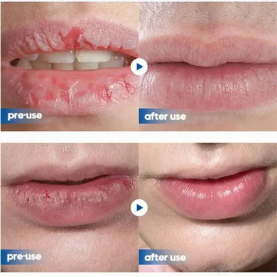 Frost Glow Cosmetics men’s lip balm hydrates, smooths lip lines & prevents cracking. Non-greasy, refreshing care for daily lip comfort.