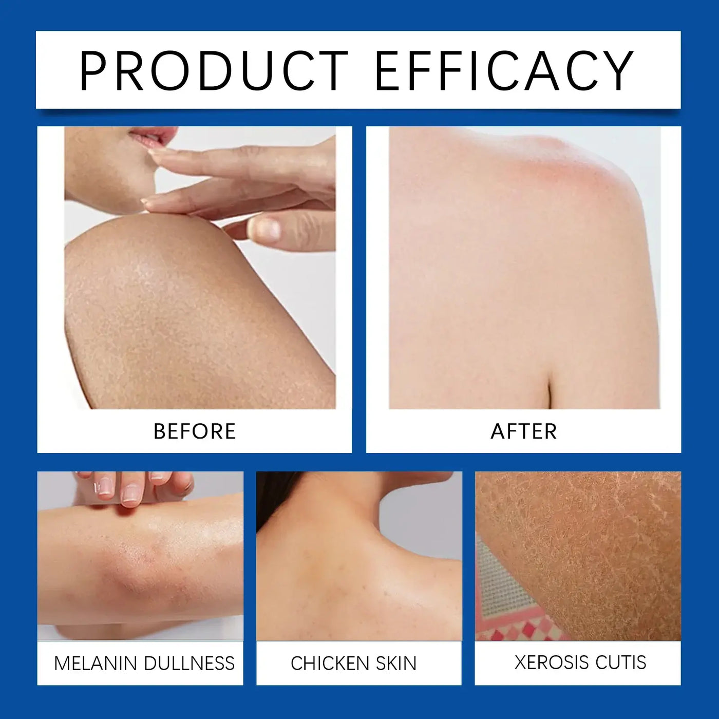 OceAura 1% Salicylic Acid Body Wash in packaging, showcasing moisturizing skin benefits, used by a person in the shower.